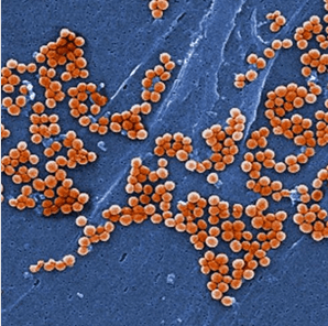 Genome Res：全基因组测序追踪耐药细菌撒播机制